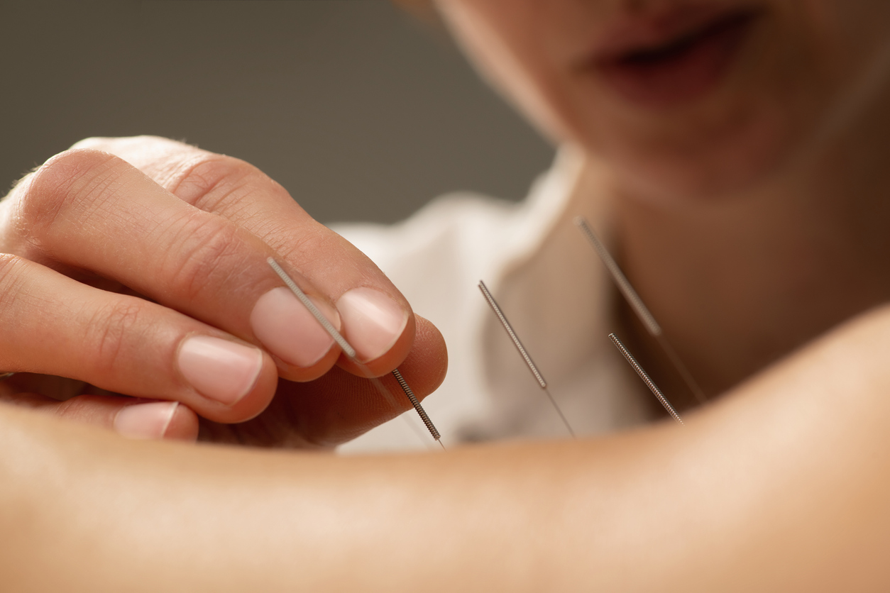 jenny-hope-acupuncture-overview-acupuncture-treatment-for-back-pain